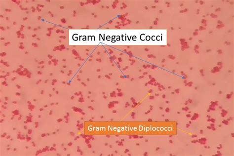 chlamydia gram negative diplococci.